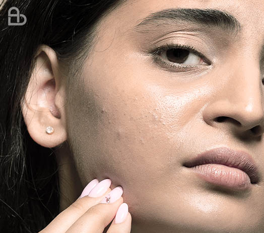 Dermatologist examining an inflamed skin rash during a clinical skin consultation